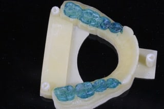 Mould of mouth with crown build up